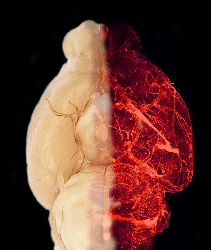 Blutgefäße im transparent erscheinenden Gehirn eines adipösen Mausmodells 