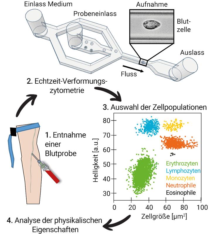 Behandlung von Blutproben, um die physikalischen Eigenschaften von Leuko­zyten und Erythrozyten zu messen