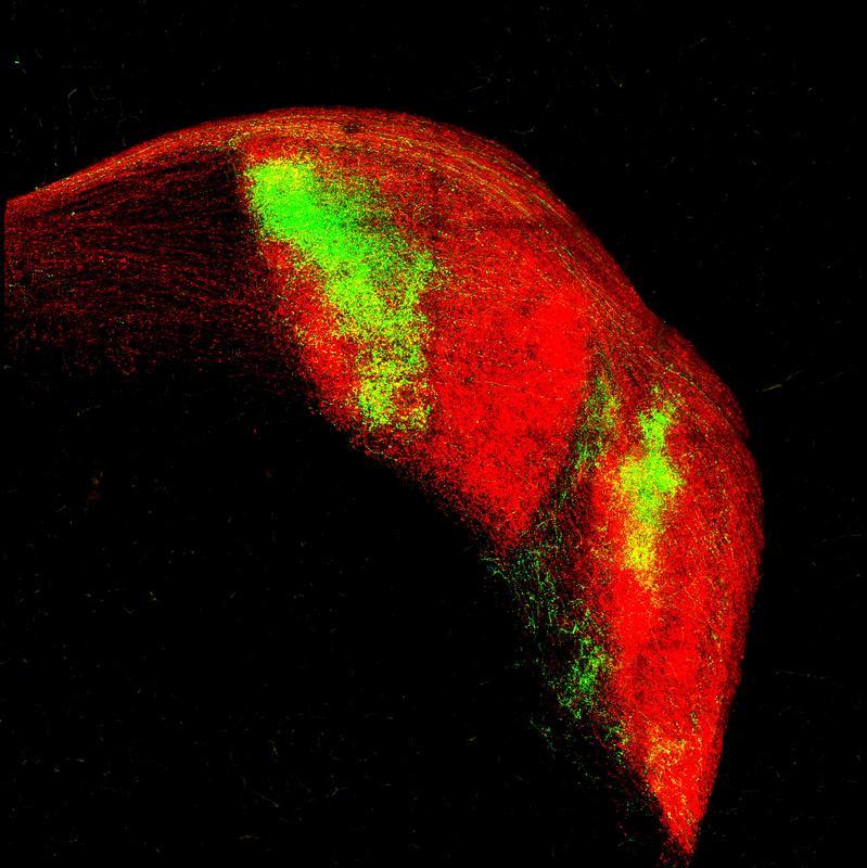 Information from both eyes reaches the visual thalamus in defined areas. Nerve fibers shown in green come from the eye located on the same side of the body as the thalamus shown, nerve fibers in red from the opposite eye. 
