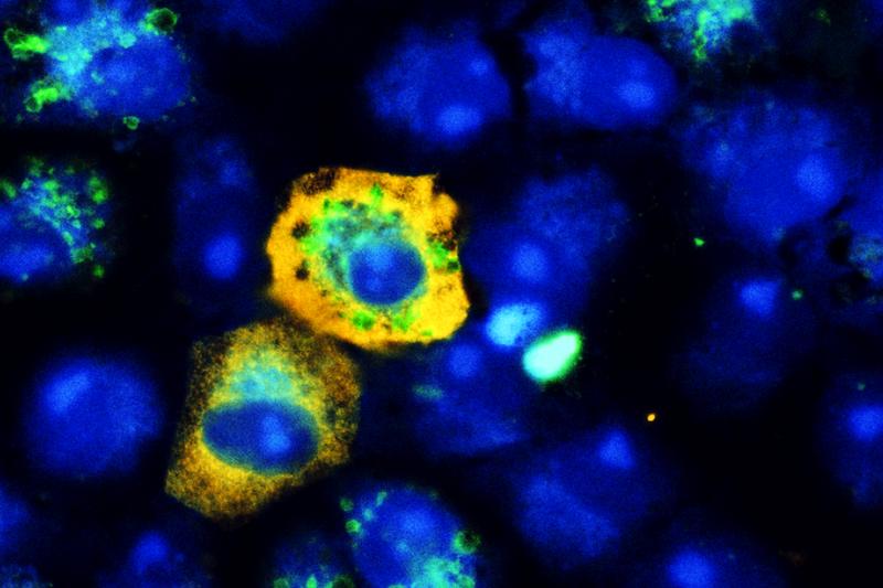 Infiziert SARS-CoV-2 (gelb) Affennierenzellen, drosselt es deren Recycling-Mechanismus: Es finden sich weniger Autophagie-Signale (grün) als in nicht infizierten Zellen. Zellkerne sind blau angefärbt.