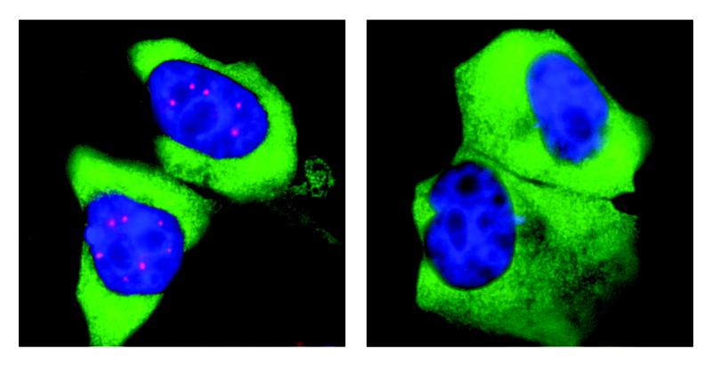 Im Zellkern menschlicher Zellen (blau) konzentriert sich SMN in den Cajal-Körpern (links, rot). Hemmt man die Phosphorylierung von SMN, unterbleibt die Konzentration und die Cajal-Körper verschwinden.