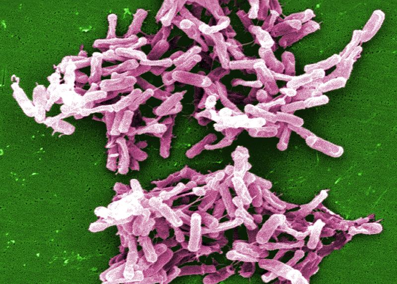 Darmbakterium Clostridioides difficile