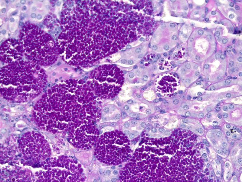 Die Candida albicans-Mutante (pink eingefärbt) vermehrte sich in der Hefe-Form massiv in der Niere einer Maus, die keine neutrophilen Granulozyten besitzt.