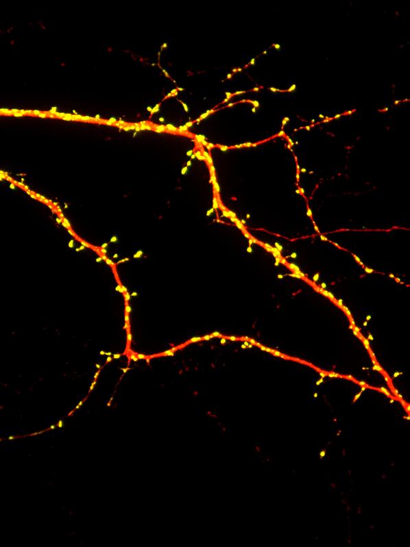Falsch gewickelt: Shank-Proteine sind wichtige Master-Organizer von erregenden Synapsen (links: gelbe Punkte). 