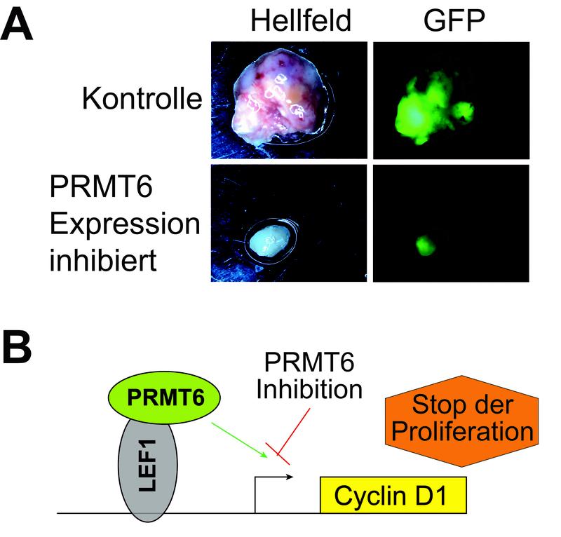 PRMT6-Inhibition als Ansatzpunkt für eine molekulare Therapie von Krebserkrankungen