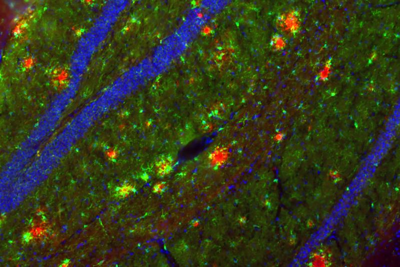 Im Hippocampus der Maus sind in roter Farbe die Aβ-Ablagerungen sichtbar gemacht worden. Um diese Alzheimer-typischen Ablagerungen in der Maus untersuchen zu können, sind spezielle Mausmodelle notwendig.