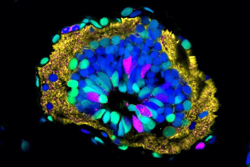 Cross-section of axolotl spinal cord. Neural stem cells are red and green in the middle, lining the hollow, fluid-filled centre of the spinal cord (central canal). Neurons are located on the outside – nerve fibres are labelled in yellow, cell nuclei blue.