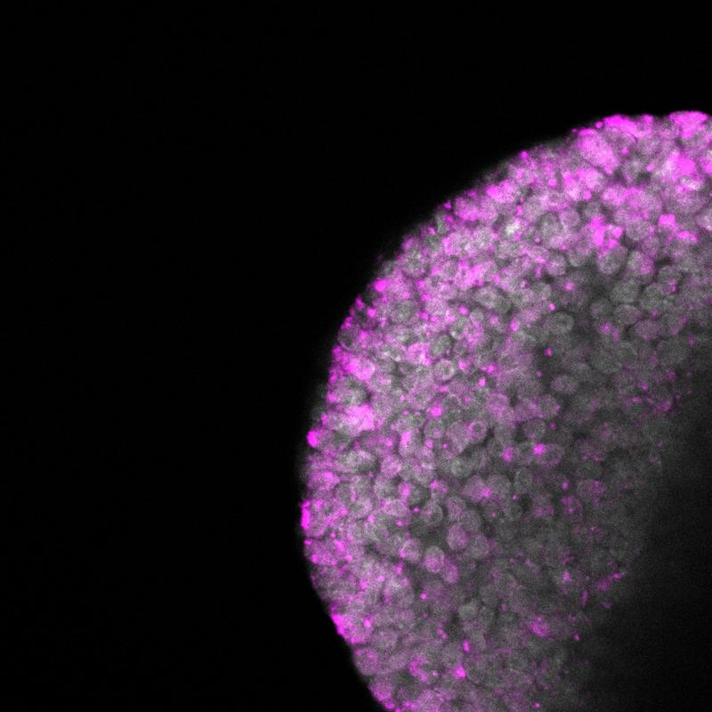 Nachdem die Methyltransferase Dnmt1 in der befruchteten Eizelle ausgeschaltet wurde, entstehen zahlreiche IAP-Retrotransposons (Retrotransposon-Moleküle pink markiert)