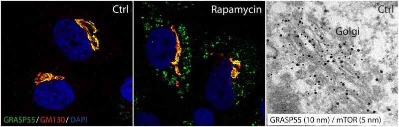 Immunfluoreszens- und elektronenmikroskopische Aufnahmen zeigen die Lokalisation von GRASP55 und mTORC.