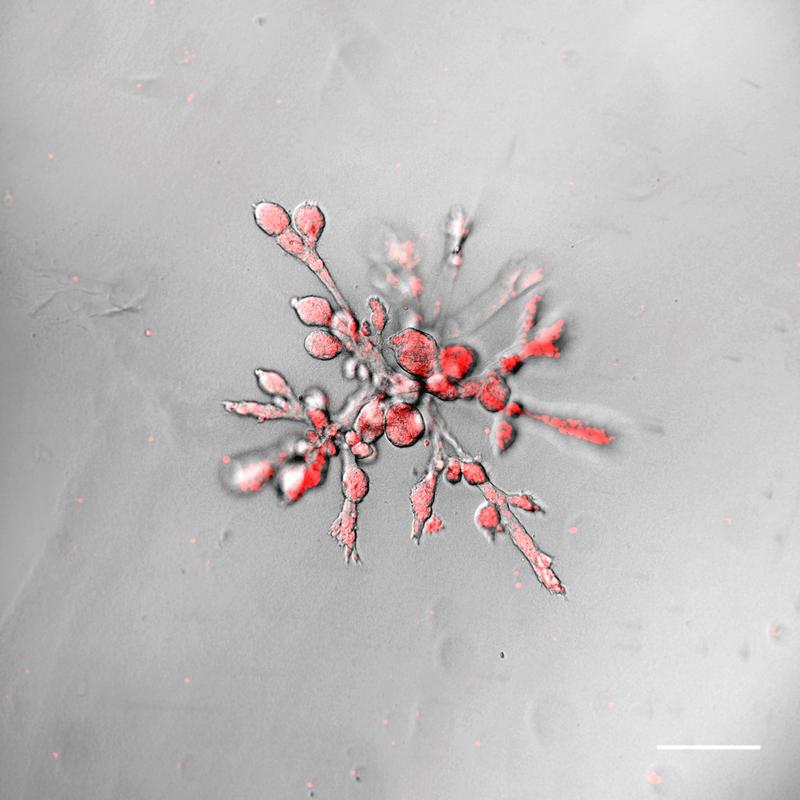 The organoids grown by the research team form branched glandular ducts whose structure and organization very closely resemble that of the human mammary gland.