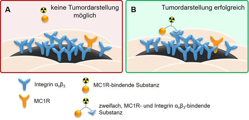 Während MC1R-bindende Substanzen nur den ursprünglichen Tumorherd gut darstellen (A), können MC1R- und Integrin αvβ3-bindende Substanzen sowohl das Melanom als auch seine Metastasen identifizieren (B).