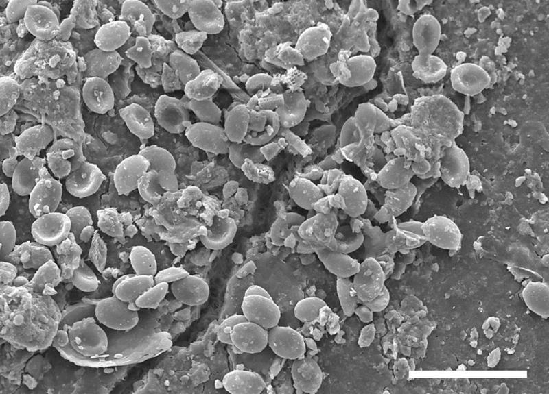 The image from a scanning electron microscope shows fungal spores along a crack in a microplastic particle. The scale bar corresponds to 30 micrometers.