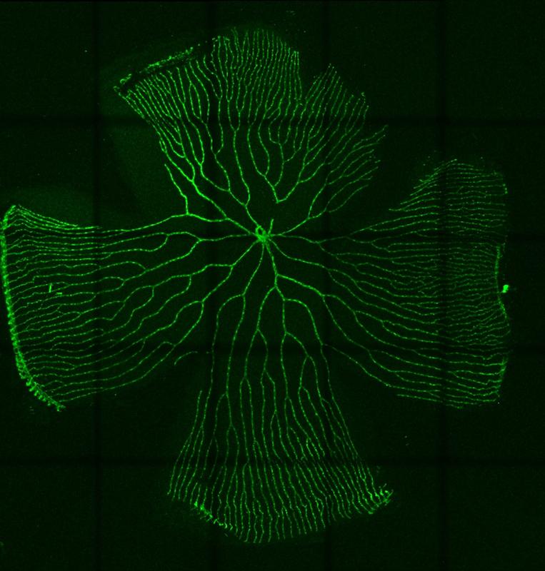 Die retinalen Blutgefäße (grün) in einem erwachsenen Zebrafischauge.