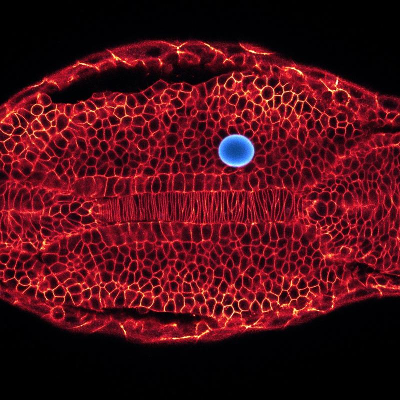 Zebrafisch-Embryo (fluoreszierend markierte Zellmembranen) mit eingebettetem Öl-Mikrotropfen der zur Darstellung von Gewebe- und Zellkräften in vivo genutzt wird.