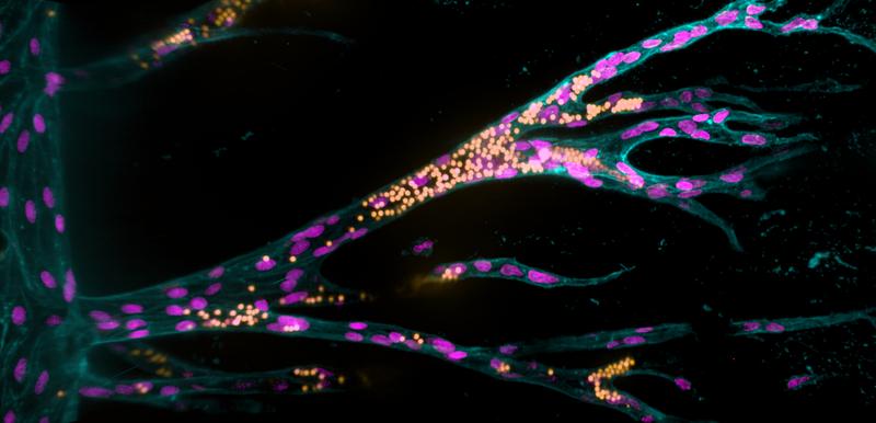 Aus einem Ursprungsblutgefäß (senkrecht links im Bild) bilden Endothelzellen (pinke Zellkerne) in einem künstlichen Hydrogel neue Blutgefäße. Fluoreszierende Kügelchen (gelb) simulieren den Blutfluss.