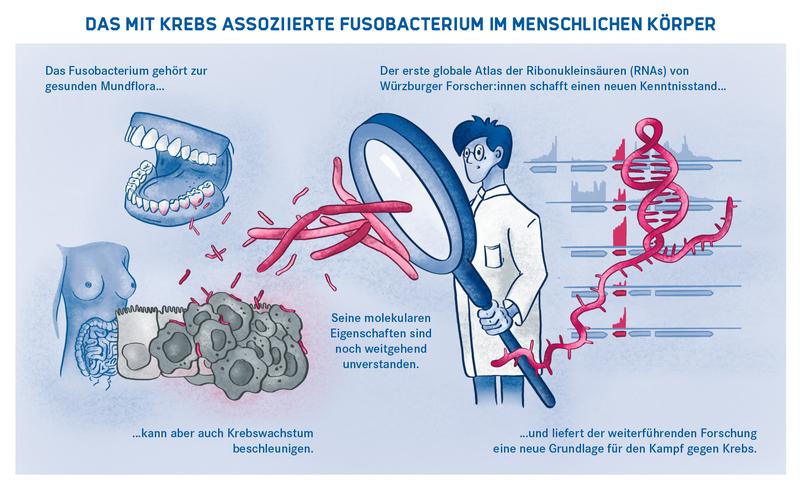 Das mit Krebs assoziierte Fusobacterium im menschlichen Körper