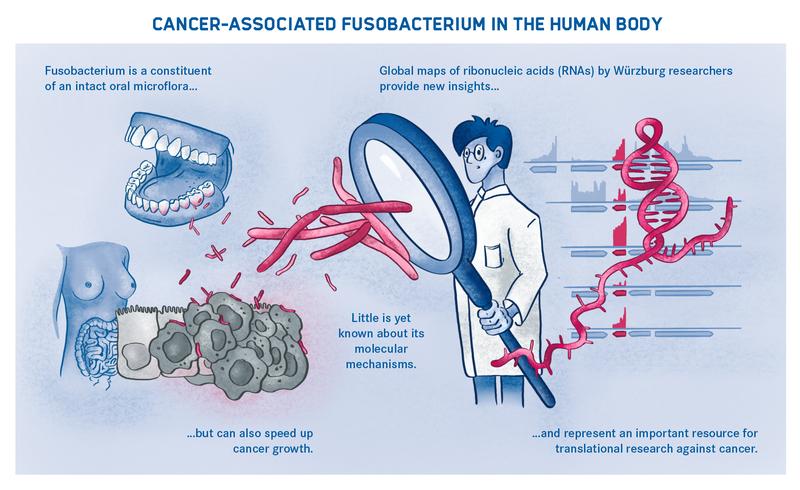 Cancer-associated Fusobacterium in the human body