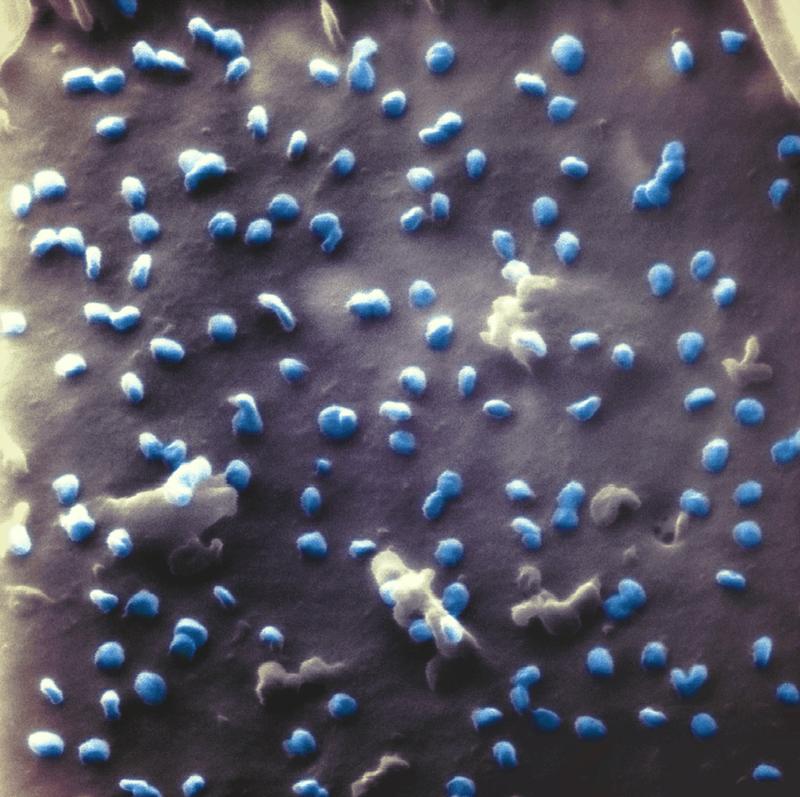 Das neue DataLab Corona bündelt die Expertise von Bielefelder Forschenden zum Coronavirus. Dazu zählt das Know-how zu bildgebenden Verfahren zur Darstellung von Coronaviren (blau), in diesem Fall aufgenommen mit einem Heliumionen-Mikroskop. 