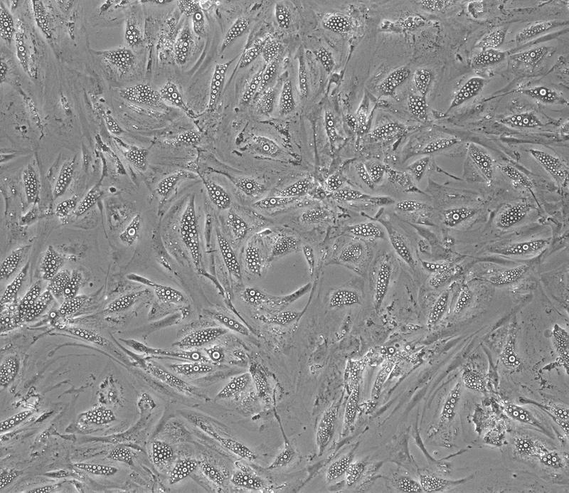 Microscopic image of human adipocytes in which lipid droplets (white) accumulate. 