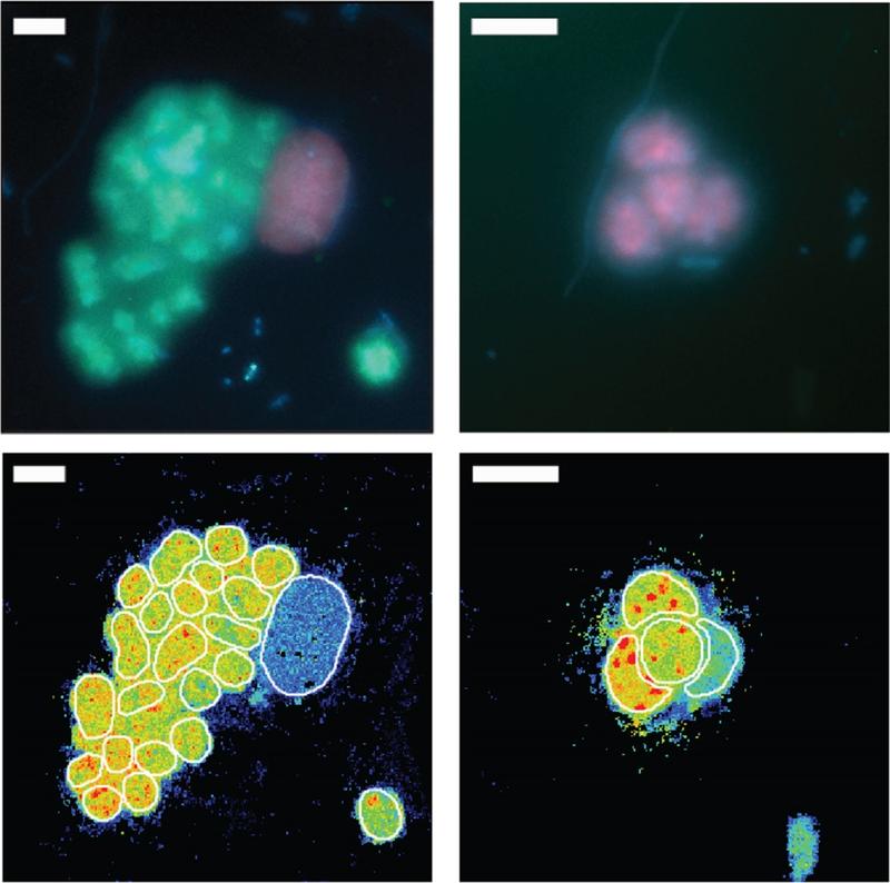Fluoreszenzbilder von Schwefelpurpurbakterien im Süßwassersee Cadagno (obere Panele, in Grün und Purpur), sowie deren Einzelzell-Stickstoff-Fixierung, gemessen am nanoSIMS (untere Panele, warme Farben bedeuten höhere Aktivität).