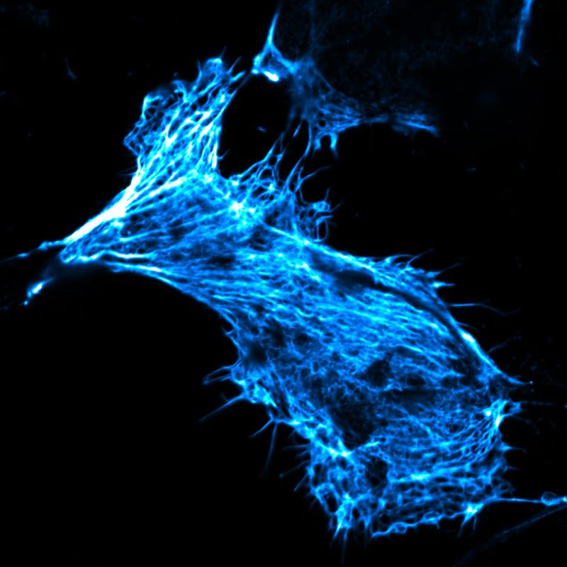Living human cancer cell in cell culture, its actin skeleton stained with fluorescent phalloidin. This toxic substance was only able to enter the cell by means of the newly developed nanocontainers.