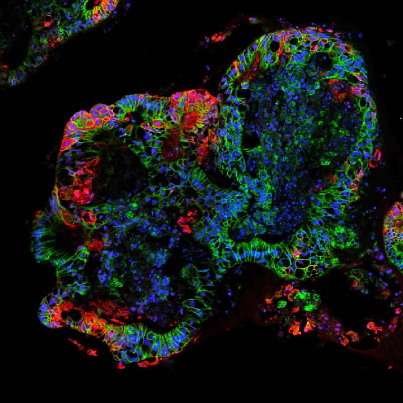 Für diese SARS-CoV-2-Studie wurden Darm-Organoide infiziert. Auf der fluoreszenzmikroskopischen Aufnahme dargestellt ist ein gefärbter Schnitt. Zu erkennen sind rot das Spike Protein in den infizierten Zellen, grün E-Cadherin und blau die Zellkerne.