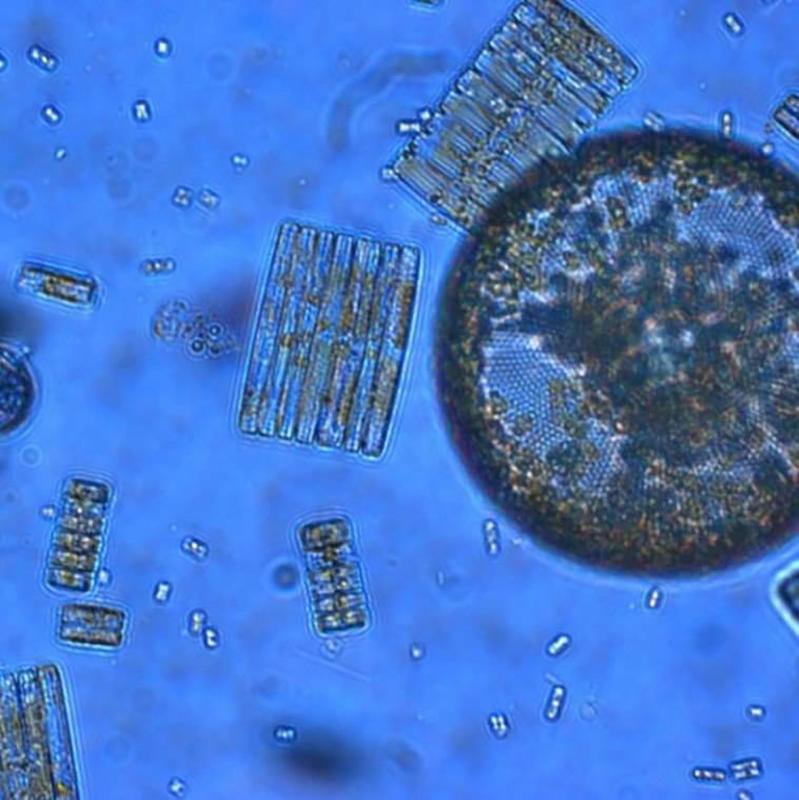 Phytoplankton aus dem Südlichen Ozean. 