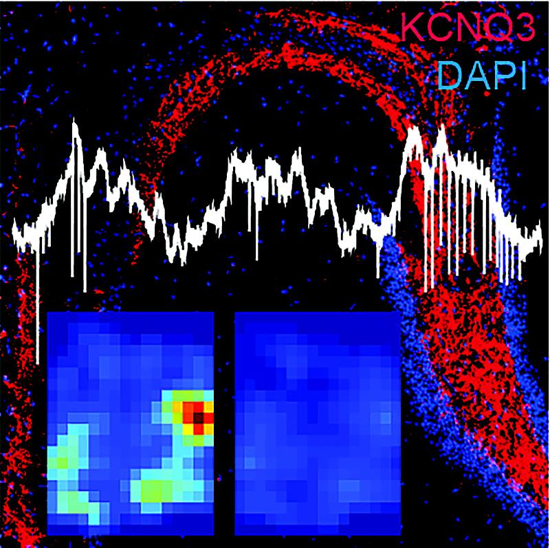 Kcnq3-Immunofluoreszenz im Hippocampus, zeitliche (weise Signalspuren) und räumliche (Ortsfelder von Salven, links, und von einzelnen Aktionspotentialen, rechts) Feuerung einer Pyramidenzelle in einer Kcnq3-Knock-Out Maus.