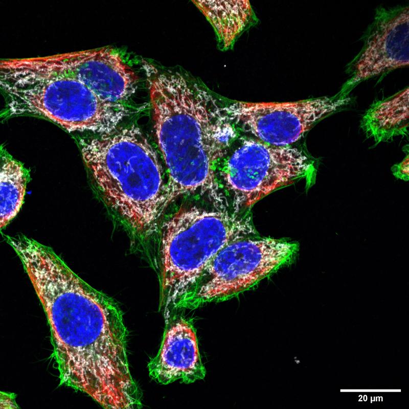 Hep-2-Zellkulturen: Studierende nahmen dieses Bild mittels konfokaler Laserscanning-Mikroskopie auf. Angefärbt: Komponenten des Zytoskeletts Aktin (Grün) und Vimentin (Rot), Tom20-Protein der Mitochondrien (Weiss) und DNA der Säugerzellen (Blau).
