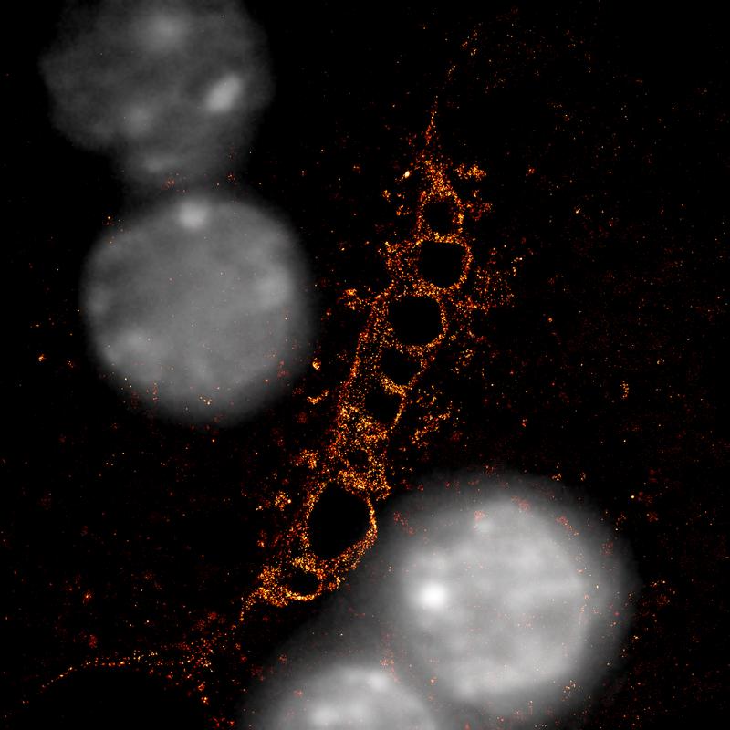 Hochauflösendes Mikroskopiebild mit Gallenkanälchen (rot), das von zwei Hepatozyten gebildet wird, mit Zellkernen in grau. Mit Einzelmolekül-Lokalisierungsmikroskopie wurde F-Actin (rot) analysiert. F-Aktin-reiche Strukturen bilden ein gestreiftes Muster.