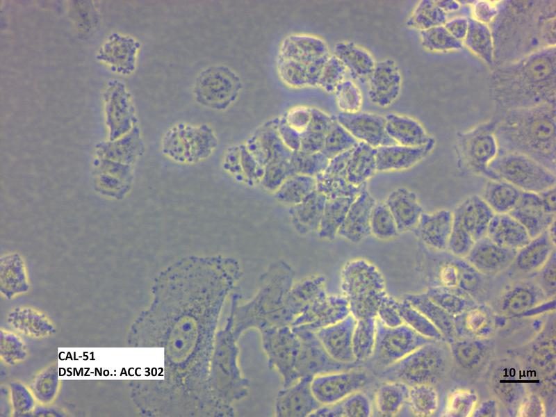 Lichtmikroskopische Aufnahme der Zelllinie CAL-51 (ACC 302)