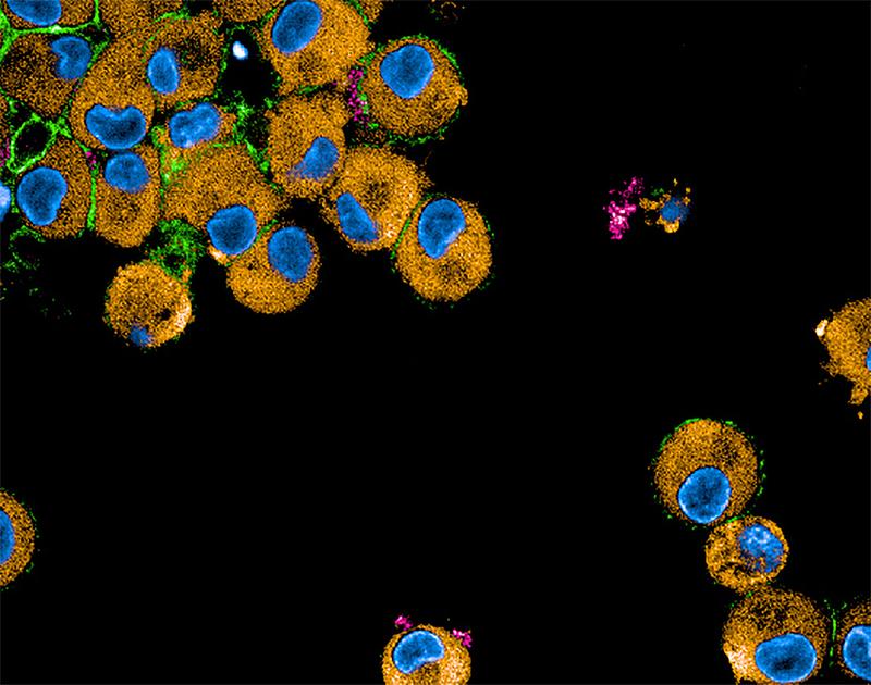 Komplement Rezeptor-gefärbte, Virus-infizierte Immunzellen (Virus in Pink; Komplementrezeptor in Grün, Zytoplasma in Orange; Zellkerne in Blau).