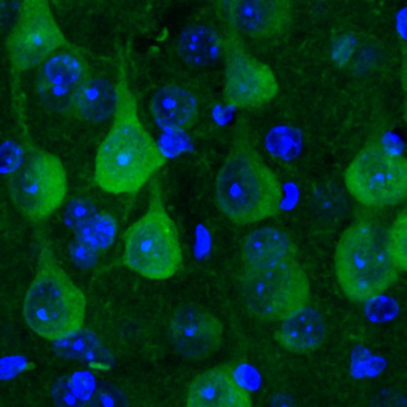 In healthy mouse neurons, the proteostasis sensor (in green) distributes evenly.