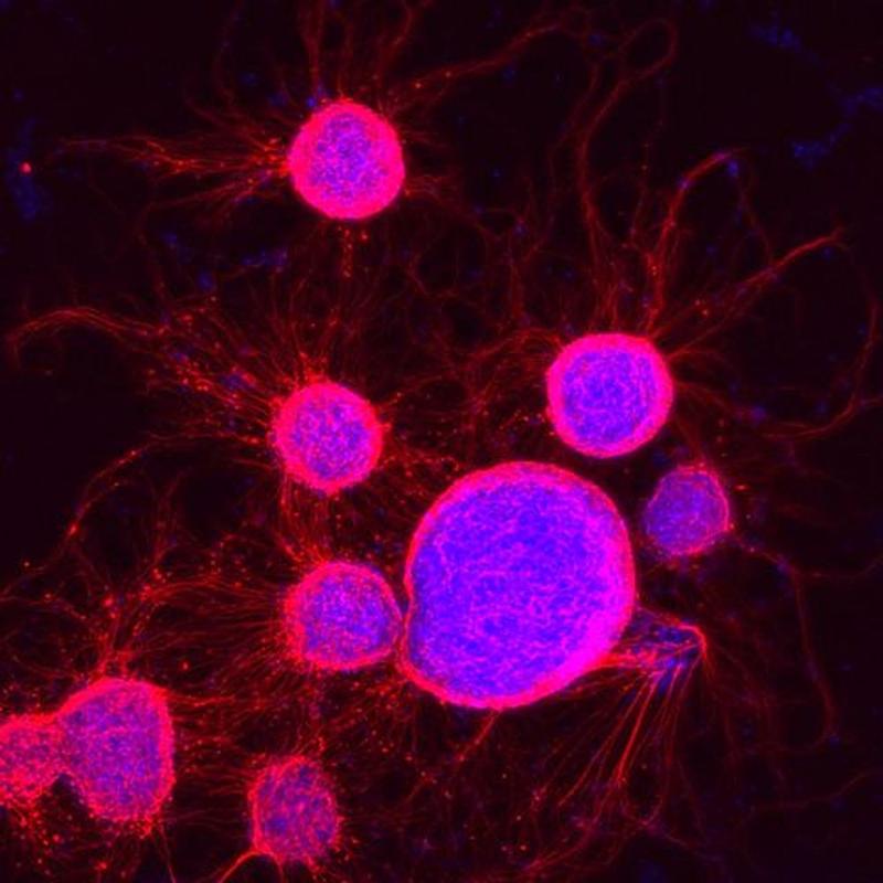 Mouse embryonic stem cells undergoing electrochemical specialization, labeled for nuclei (blue) and neuron projections (red).