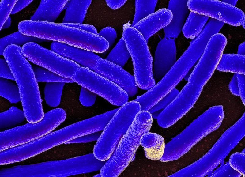 Das stäbchenförmige Escherichia coli-Bakterium kann schwere Infektionen verursachen (rasterelektronenmikroskopische Aufnahme).