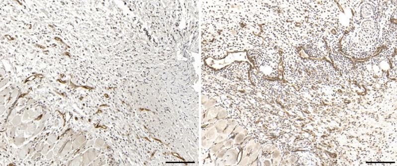 Immunohistochemical imaging of blood vessels in skin lesions during bacterial infection in a mouse without the signaling factor (right) and a normal mouse (left)