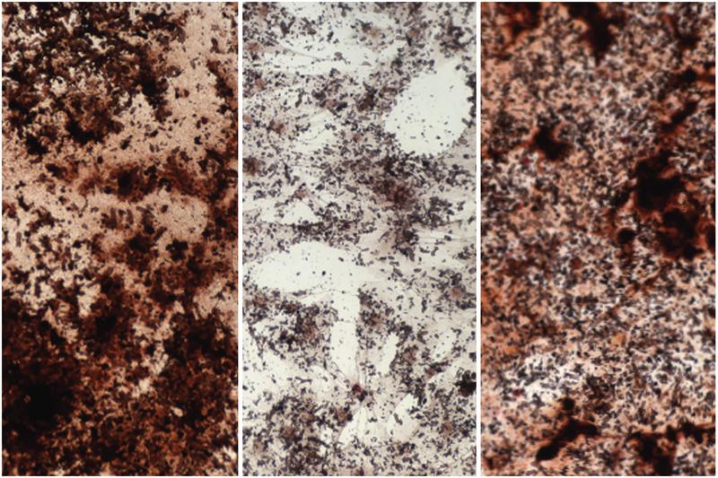Stained calcium (dark brown) in stem cells from the bone marrow: Young stem cells (left) produce more material for bone than old stem cells (center). They can be rejuvenated by adding sodium acetate (right). 