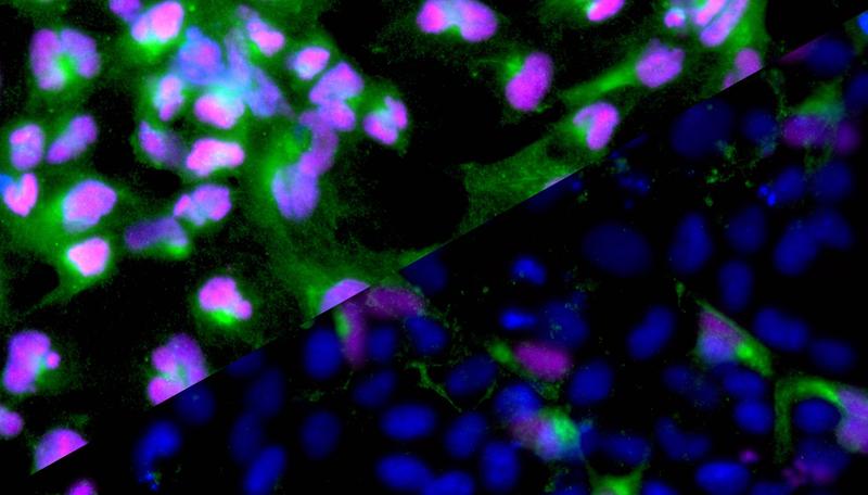 Before (left) and after (right) excising loop domain boundaries from isolated gene SOX17. Without its loop, activity of the gene (pink) comes to a standstill. But endoderm markers like CXCR4 (green) get less expressed, too