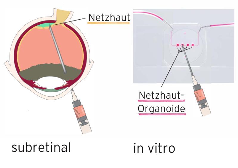 Schematische Darstellung der subretinalen Injektion unter die Netzhaut und in den in vitro Organ-Chip © µOrgano-Lab