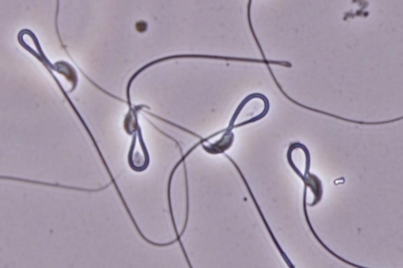 SPACA4 localisation in mouse sperm. Credit: Osaka University