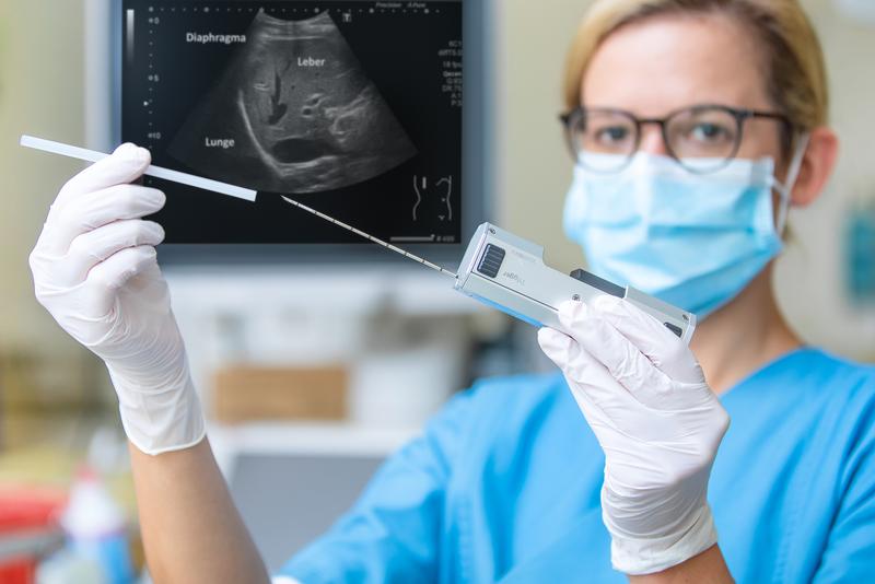 A biopsy needle with which doctors regularly take tissue samples in order to individually control the immunosuppression for each patient. 