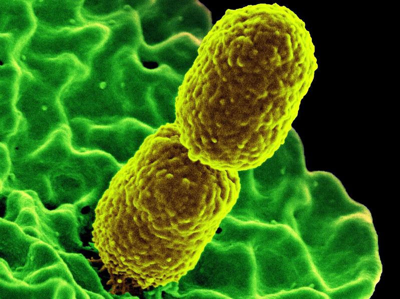 Der Darmbewohner Klebsiella pneumoniae ist einer der gefürchteten Krankenhauskeime.