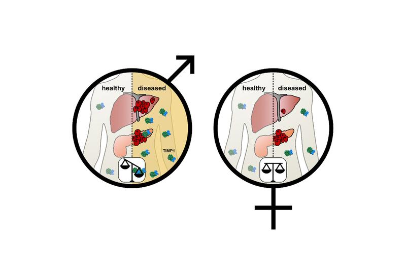 The difference in TIMP1 levels between the sexes: The male-specific increase of TIMP1 levels causes a significantly higher risk, both for metastasis of the tumor in the liver and for earlier death.