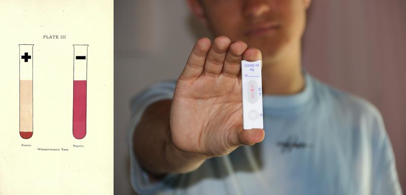 A graphical representation of the Wassermann test to detect serological reactants associated with syphilis and a person holding a negative Covid-19 antigen test.