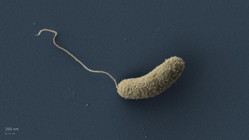 Electron micrograph of a cholera pathogen Vibrio cholerae (colourised).