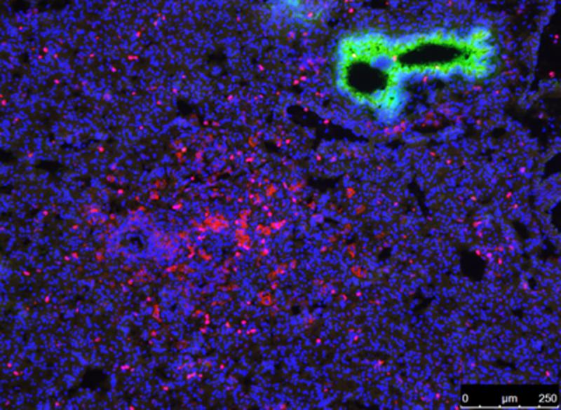 Neutrophile (rot), die in der Lunge, in der Nähe der terminalen Bronchiolen (grün), rekrutiert werden.