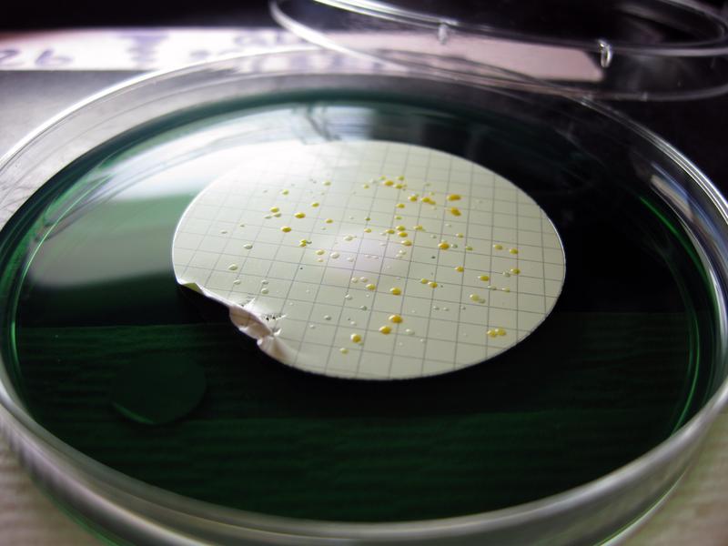 Vibrio-Kolonien, die auf einem Filter wachsen
