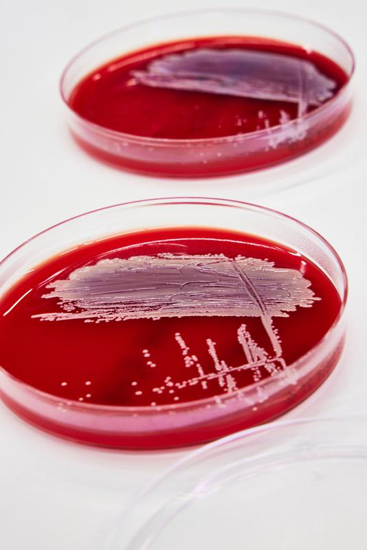 Staphylococcus aureus - hier angezüchtet auf einer Kulturplatte - ist ein Hautbakterium, das schwere Wundinfektionen verursachen kann und überdies schnell gegen Antibiotika resistent wird. 