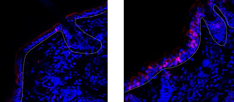 In inflamed skin keratinocytes with the receptor for interleukin-12 (left) divide less than keratinocytes without this receptor (right). Red: cells during division, blue: cell nuclei, white line: epidermis.