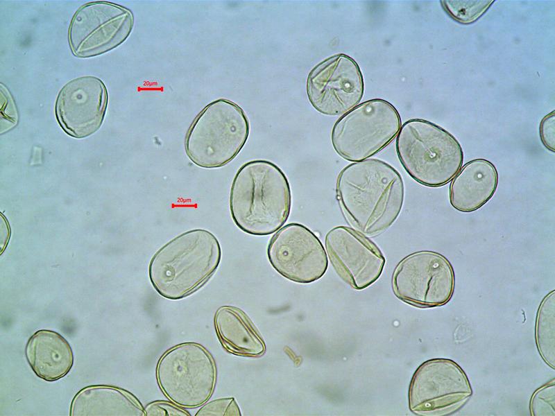 Pollen im Sediment erlauben Rückschlüsse auf die Landschaftsentwicklung. Hier eine Mikroskopaufnahme von Binkelweizen (Triticum compactum).